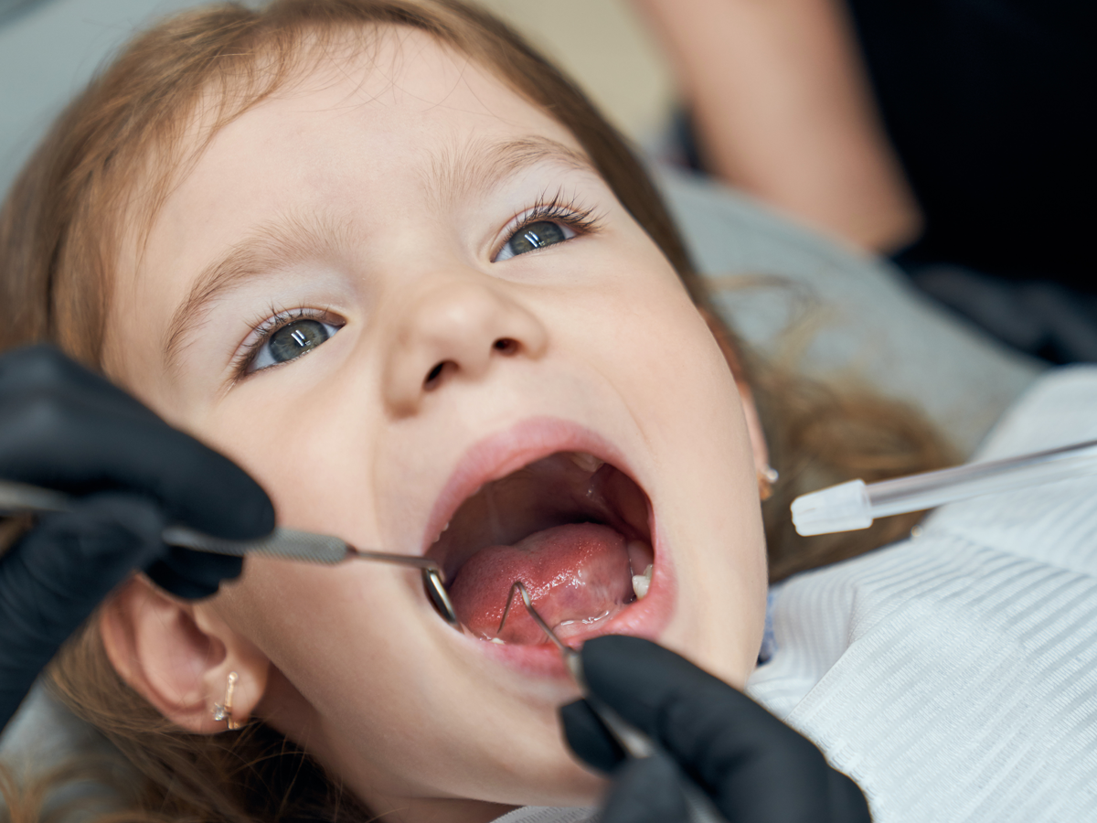 Eryaman Çocuk Dişçi Tavsiye
